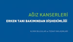 Ağız Kanserleri - Erken Tanı Bakımından Dişhekimliği Klinik Bulgular ve Tedavi Yaklaşımları