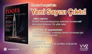 Çaylar Hazırsa Roots Dergisi’ne Yakından Bakalım