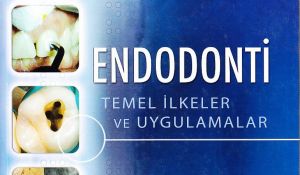 Endodonti Temel İlkeler ve Uygulamalar