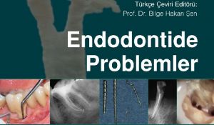 Endodontide Problemler - Etiyoloji, Tanı ve Tedavi