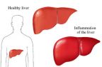 Hepatit Cli kadın hastanın iddiası: Dişhekimi beni muayene etmedi