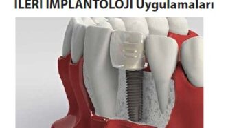 İnci Dental’den İleri İmplantoloji Kursu