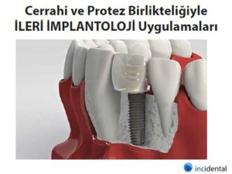 İnci Dental’den İleri İmplantoloji Kursu