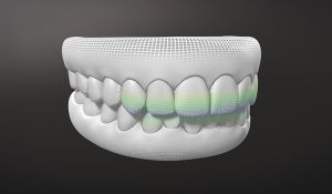 Invisalign G8 Türkiye Dental Piyasasında Yerini Aldı