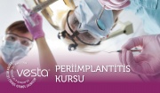 VESTA'dan Yeni Kurs: Periimplantitis