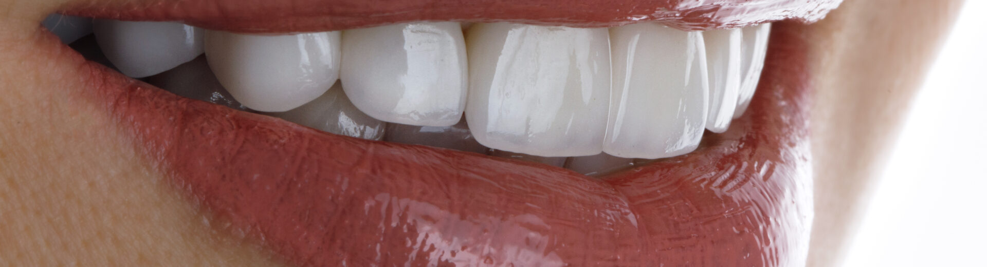 British Dental Journal’da yayımlanan yeni araştırma, İngiliz medyasının “Turkey Teeth” haberleri üzerinden dental turizme yaklaşımını inceliyor; bulgular, damgalayıcı dil ve estetik baskıların öne çıktığını gösteriyor.