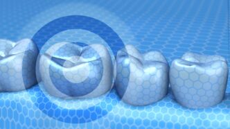 Dr. Miguel Stanley’nin Aligners International’da yayımlanan görüş yazısı, revizyon diş hekimliği kavramını ele alıyor. Yaşlanan dental materyallerin sistemik hastalıklarla ilişkisini ortaya koyarak, proaktif sağlık modeline geçilmesi gerektiğini vurguluyor.