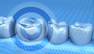 Dr. Miguel Stanley’nin Aligners International’da yayımlanan görüş yazısı, revizyon diş hekimliği kavramını ele alıyor. Yaşlanan dental materyallerin sistemik hastalıklarla ilişkisini ortaya koyarak, proaktif sağlık modeline geçilmesi gerektiğini vurguluyor.