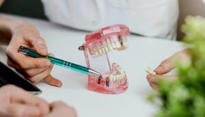 dental implant